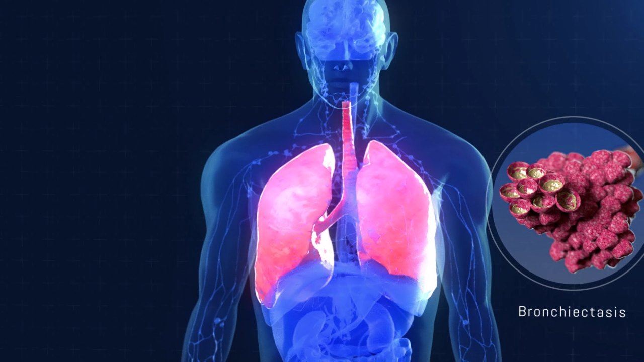 All About APDS — Pharming